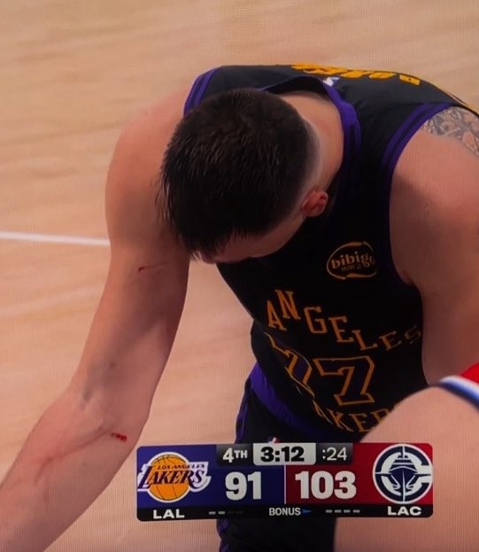 ggbet网页版-谁抓的~东契奇罚球时看向手臂 好几道伤口&amp;血迹斑斑